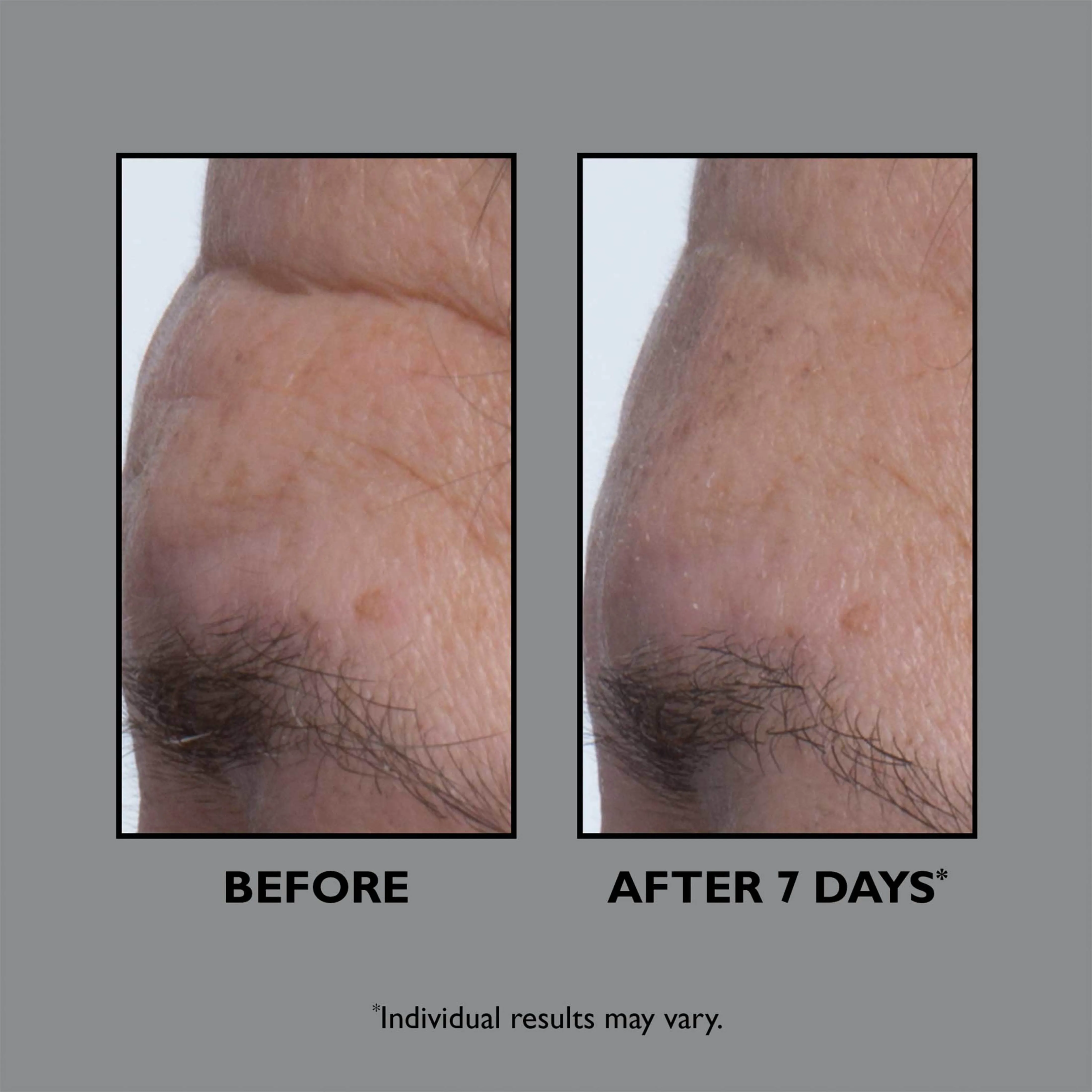 FIRMx® Collagen Serum