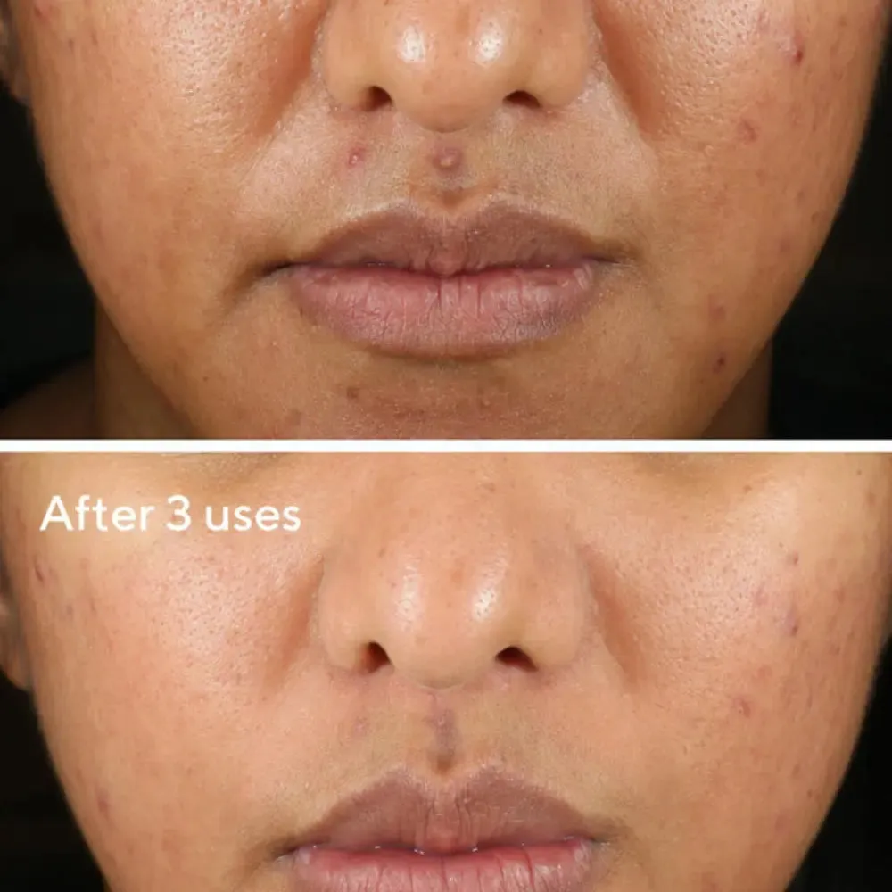 Murad Rapid Relief Sulfur Mask 74ml