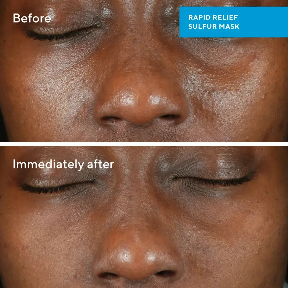 Murad Rapid Relief Sulfur Mask 74ml